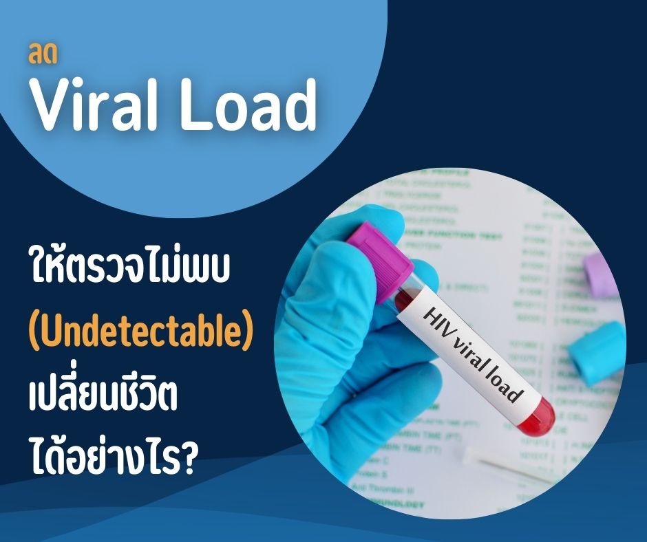 ลด Viral Load ให้ตรวจไม่พบ (Undetectable) เปลี่ยนชีวิตได้อย่างไร?