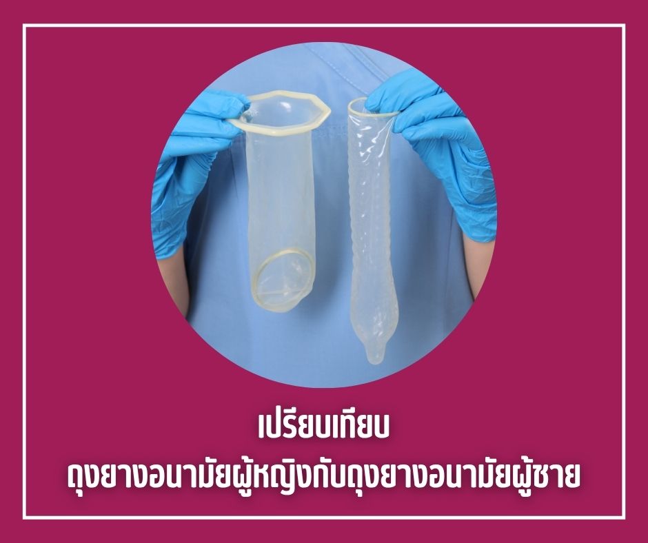 เปรียบเทียบถุงยางอนามัยผู้หญิงกับถุงยางอนามัยผู้ชาย