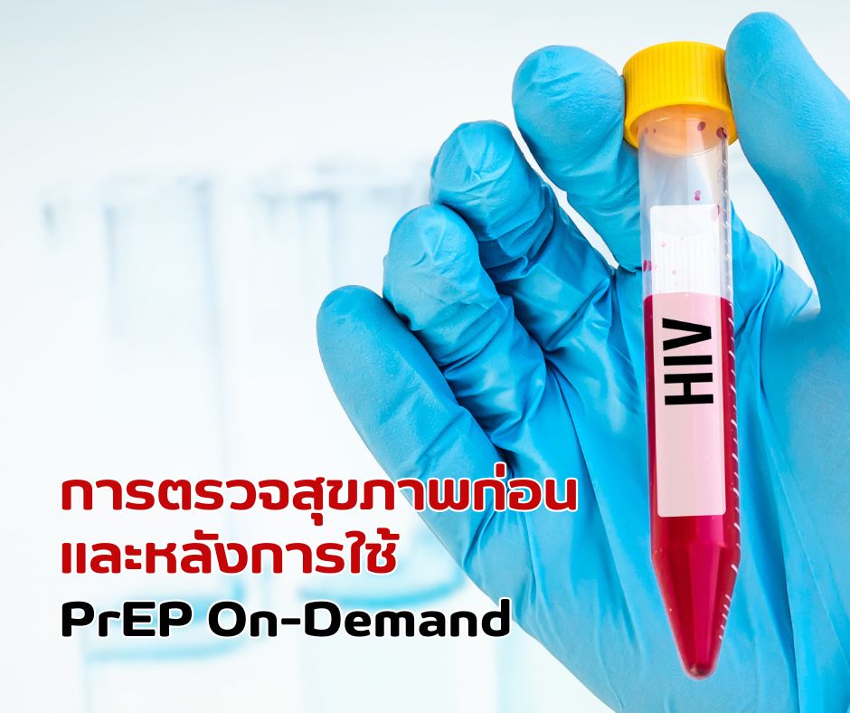 การตรวจสุขภาพก่อน และหลังการใช้ PrEP On-Demand