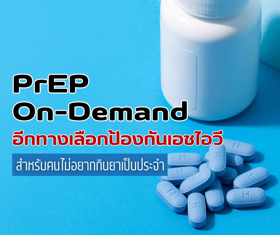 PrEP On-Demand อีกทางเลือกป้องกันเอชไอวี สำหรับคนไม่อยากกินยาเป็นประจำ