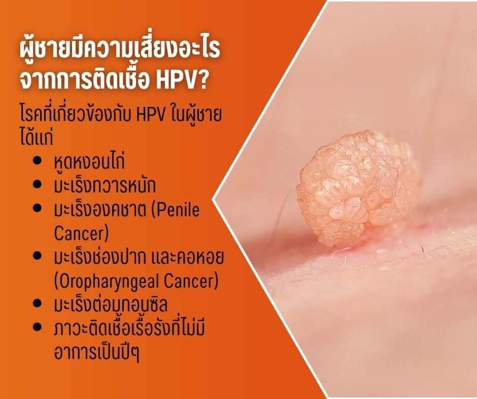 ผู้ชายมีความเสี่ยงอะไรจากการติดเชื้อ HPV