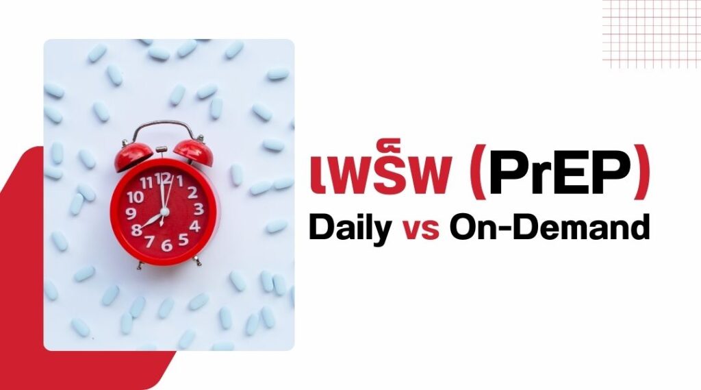เพร็พ Daily vs On-Demand