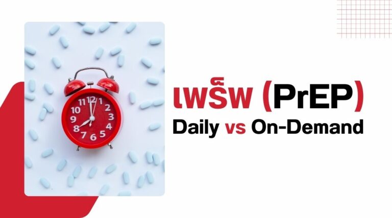 เพร็พ Daily vs On-Demand
