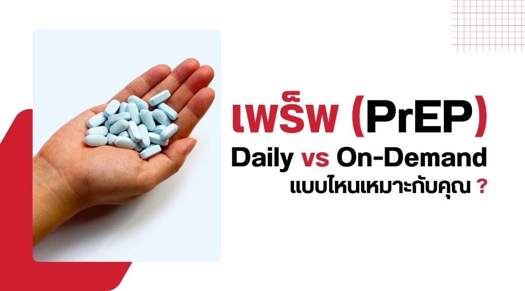 เพร็พ Daily vs On-Demand แบบไหนเหมาะกับคุณ