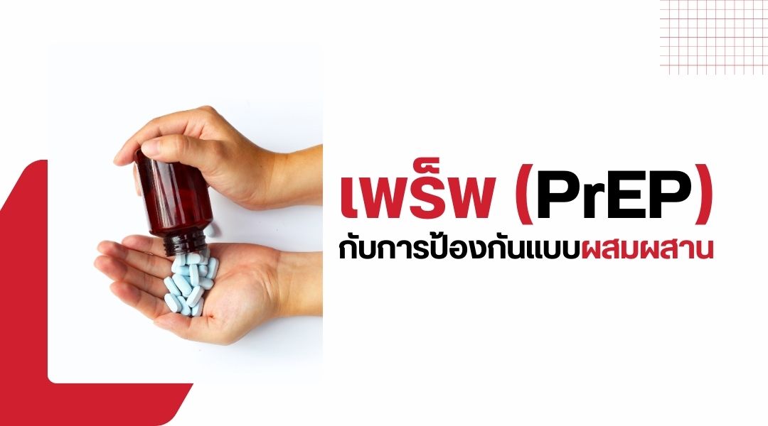 เพร็พ กับการป้องกันแบบผสมผสาน